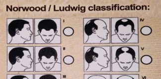 Vinci Hair Clinic to host global conference on hair loss