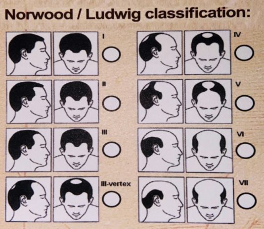 Vinci Hair Clinic to host global conference on hair loss